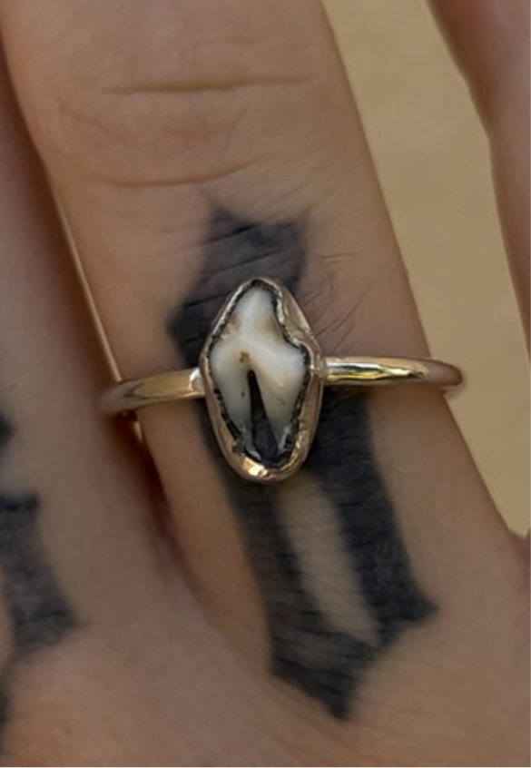 CUSTOM TOOTH RING