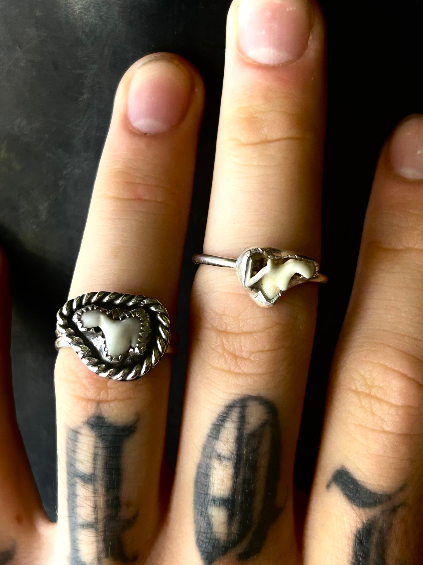 CUSTOM TOOTH RING