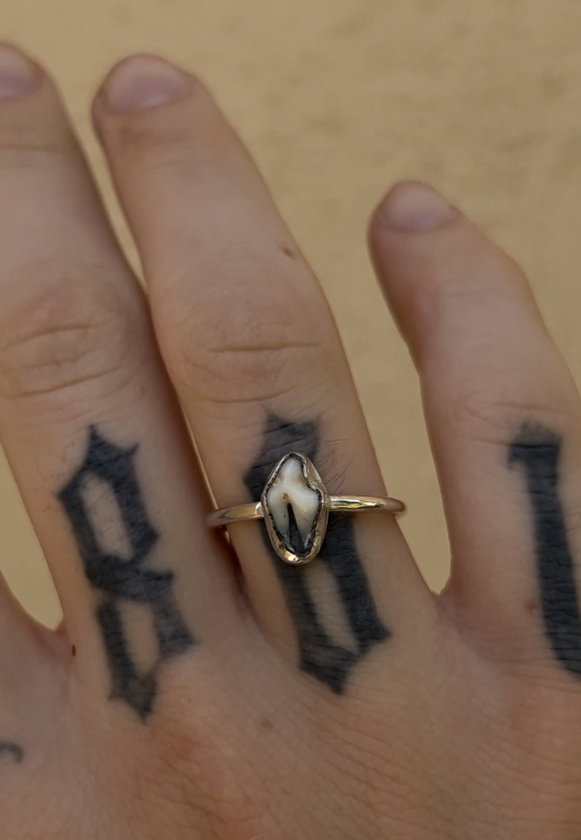 CUSTOM TOOTH RING