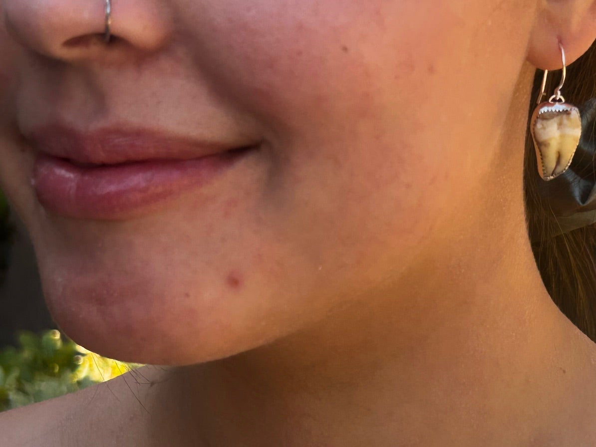 CUSTOM TOOTH EARRINGS
