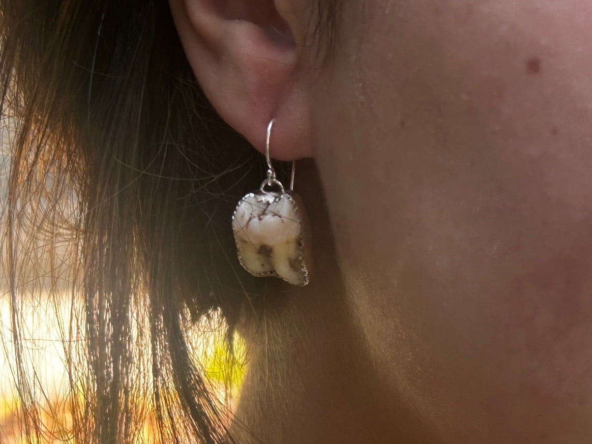 CUSTOM TOOTH EARRINGS